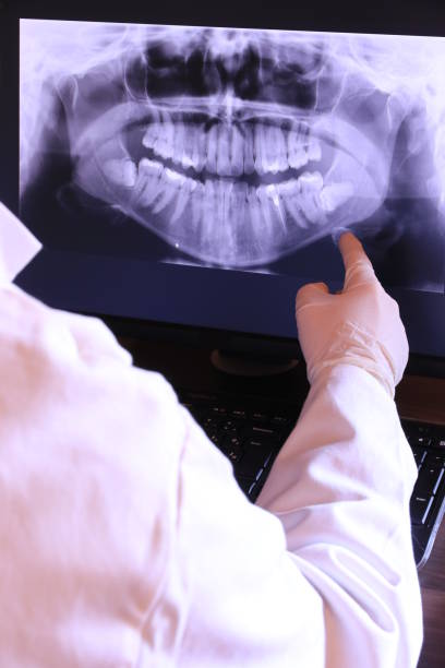 Best Emergency Care for Gum Disease in Holiday City South, NJ